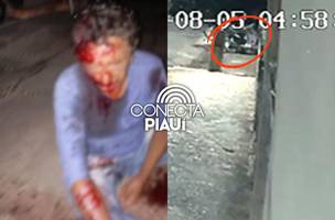 Homem é brutalmente apedrejado durante tentativa de assalto em Piracuruca (Foto: Imagens enviadas ao Conecta Piauí)