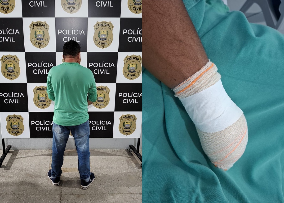Suspeito de decepar mão de vizinho após disputa por terras é preso em Campo Maior