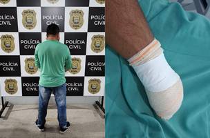 Suspeito de decepar mão de vizinho após disputa por terras é preso em Campo Maior (Foto: Divulgação/Polícia Civil)