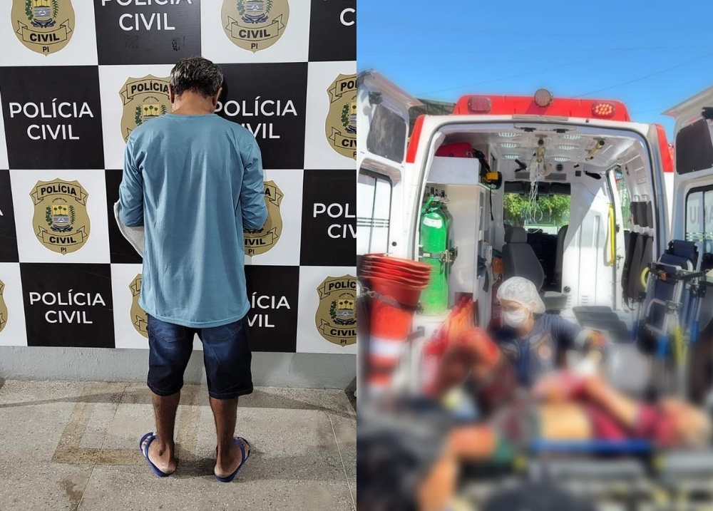 Suspeito de furtos que teve as mãos decepadas é preso com comparsa em Campo Maior